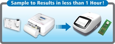 Truelab Uno Dx Real-Time Quantitative Micro PCR Analyzer at Mangalam Diagnostic Center
